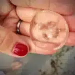 Myths About Blastocysts