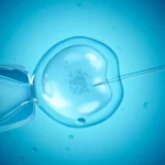 Blastocyst Transfer