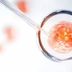 Intended mother in her forties consulting about donor egg IVF